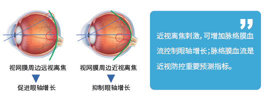 周边离焦理论